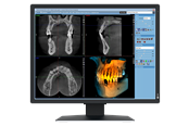 Skjerm - 21" EIZO RadiForce MX217-SB - 1200x1600 - IPS - MX217-SB